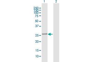 PBLD1 antibody  (AA 1-288)