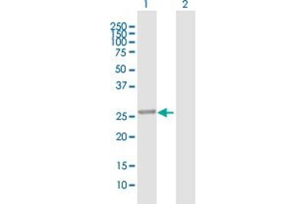 PBLD1 antibody  (AA 1-288)