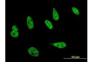 Immunofluorescence of monoclonal antibody to HIPK1 on HeLa cell.