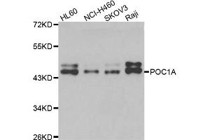 Western blot analysis of extracts of various cell lines, using POC1A antibody (ABIN4904805) at 1:1000 dilution. (POC1A antibody)