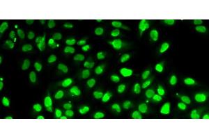 Immunofluorescence analysis of HeLa cells using PBEF / NAMPT Polyclonal Antibody (NAMPT antibody)