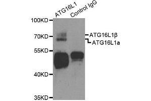 Western Blotting (WB) image for anti-ATG16 Autophagy Related 16-Like 1 (ATG16L1) antibody (ABIN1871137)