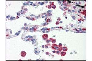 Immunohistochemistry (IHC) image for anti-Interferon Regulatory Factor 7 (IRF7) (AA 1-150), (N-Term) antibody (ABIN263915) (IRF7 antibody  (N-Term))