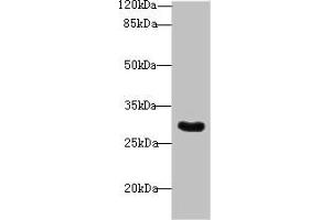Western blot All lanes: Snrnp35 antibody at 12 μg/mL + Jurkat whole cell lysate Secondary Goat polyclonal to rabbit IgG at 1/10000 dilution Predicted band size: 29 kDa Observed band size: 29 kDa (SNRNP35 antibody  (AA 1-244))