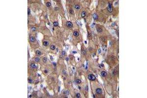 Immunohistochemistry analysis in formalin fixed and paraffin embedded human liver tissue reacted with MAT1A Antibody (N-term) followed which was peroxidase conjugated to the secondary antibody and  followed by DAB staining. (MAT1A antibody  (N-Term))