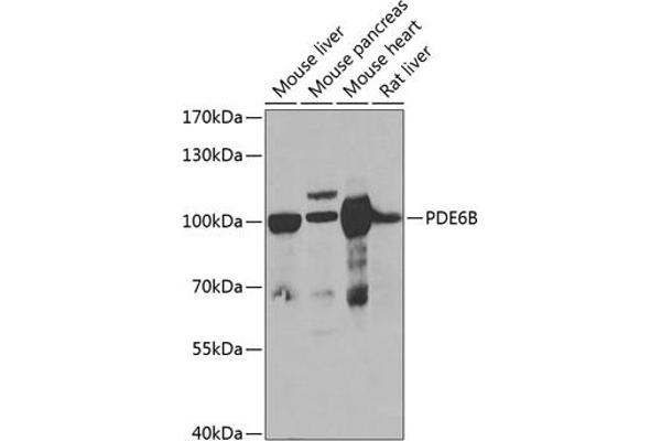 PDE6B antibody  (AA 1-190)