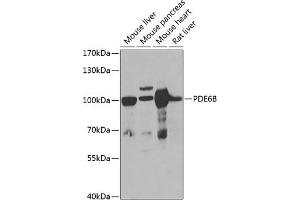 Western blot analysis of extracts of various cell lines, using PDE6B antibody (ABIN6132473, ABIN6145363, ABIN6145364 and ABIN6222688) at 1:1000 dilution. (PDE6B antibody  (AA 1-190))
