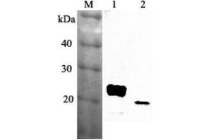 Western blot analysis using anti-RBP4 (mouse), pAb  at 1:2'000 dilution. (RBP4 antibody)