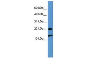 Image no. 1 for anti-Ribosomal Protein S27a (RPS27A) (AA 73-122) antibody (ABIN6746581) (RPS27A antibody  (AA 73-122))