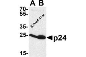 Western Blotting (WB) image for anti-Human Immunodeficiency Virus 1 Capsid (HIV-1 p24) antibody (ABIN1077455) (HIV-1 p24 antibody)