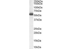 Image no. 1 for anti-Aldehyde Dehydrogenase 1 Family, Member A1 (ALDH1A1) (Internal Region) antibody (ABIN374658) (ALDH1A1 antibody  (Internal Region))