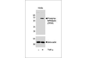 Western blot analysis of lysates from Hela cell line, untreated or treated with TNF-α, 20 ng/mL, using Phospho-NFKBp65 Antibody  (upper) or Beta-actin (lower). (NFkB antibody  (pSer536))