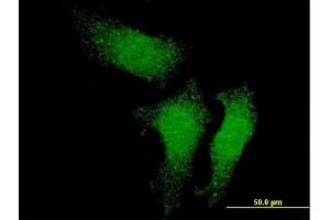 Immunofluorescence of monoclonal antibody to RUVBL1 on HeLa cell. (RUVBL1 antibody  (AA 1-456))