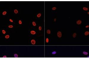 Immunofluorescence analysis of NIH/3T3 cells using Acetyl-Histone H4-K91 Polyclonal Antibody at dilution of 1:100.