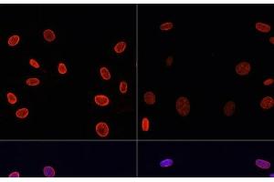 Immunofluorescence analysis of NIH/3T3 cells using Acetyl-Histone H4-K91 Polyclonal Antibody at dilution of 1:100. (Histone H4 antibody  (acLys91))