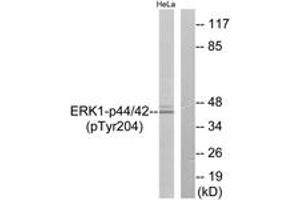 Western blot analysis of extracts from HeLa cells treated with EGF 200ng/ml 30', using p44/42 MAP Kinase (Phospho-Tyr204) Antibody. (ERK1/2 antibody  (pTyr204))
