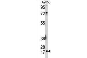 Western Blotting (WB) image for anti-Ubiquitin-Conjugating Enzyme E2I (UBE2I) antibody (ABIN2995752) (UBE2I antibody)