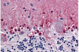 Human Brain, Cerebellum: Formalin-Fixed, Paraffin-Embedded (FFPE) (CBS antibody  (AA 1-101))