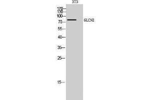 Western Blotting (WB) image for anti-Glucosamine (UDP-N-Acetyl)-2-Epimerase/N-Acetylmannosamine Kinase (GNE) (C-Term) antibody (ABIN3175276) (GNE antibody  (C-Term))
