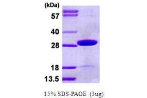 SDS-PAGE (SDS) image for Thiamin Pyrophosphokinase 1 (TPK1) (AA 1-243) protein (His tag) (ABIN667678)