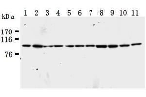 Western Blotting (WB) image for anti-Karyopherin (Importin) beta 1 (KPNB1) antibody (ABIN1449199) (KPNB1 antibody)