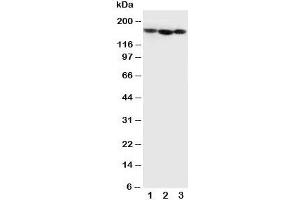 Western blot testing of Collagen IV antibody and Lane 1:  MCF-7;  2: SCG;  3: SW620 cell lysate (COL4A1 antibody  (C-Term))