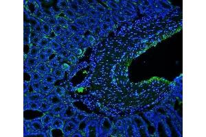 IF analysis of MCAM using anti-MCAM antibody (ABIN7601026). (MCAM antibody  (AA 27-621))