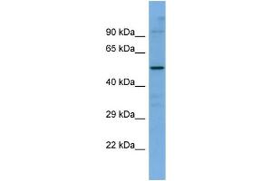 Host:  Rabbit  Target Name:  SLC5A7  Sample Type:  ACHN Whole Cell lysates  Antibody Dilution:  1.