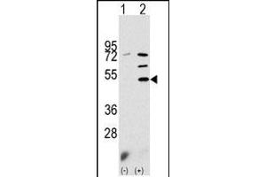 Western blot analysis of PDK3 (arrow) using rabbit polyclonal PDK3 Antibody (N-term) (ABIN391038 and ABIN2841204).