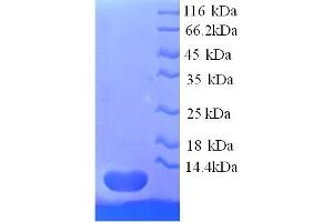 Chemokine (C-C Motif) Ligand 18 (Pulmonary and Activation-Regulated) (CCL18) (AA 21-89) protein (His tag)