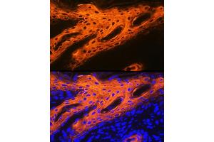 Immunofluorescence analysis of human skin using Cytokeratin 2e (KRT2) Rabbit mAb (ABIN1680763, ABIN3016322, ABIN3016323 and ABIN7101480) at dilution of 1:100 (40x lens). (Keratin 2 antibody)