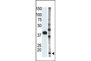 Image no. 1 for anti-Small Ubiquitin Related Modifier 2 (SUMO2) (C-Term) antibody (ABIN356794) (SUMO2 antibody  (C-Term))
