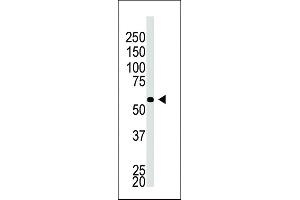 The anti-BACE2C C-term Pab (ABIN390057 and ABIN2837930) is used in Western blot to detect BACE2C in A549 cell lysate. (BACE2C antibody  (C-Term))