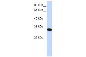 Western Blotting (WB) image for anti-PHD Finger Protein 19 (PHF19) antibody (ABIN2459400)