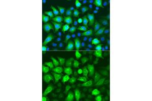 Immunofluorescence analysis of A549 cells using RRM2 antibody. (RRM2 antibody)
