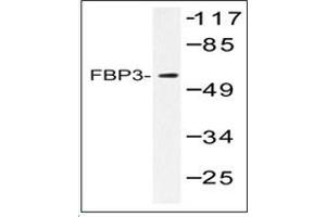 Image no. 2 for anti-Far Upstream Element (FUSE) Binding Protein 3 (FUBP3) antibody (ABIN317906)