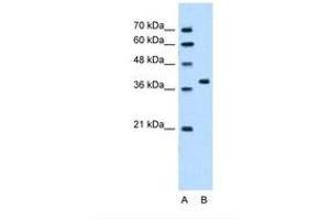 Image no. 2 for anti-RUN Domain Containing 2A (RUNDC2A) (N-Term) antibody (ABIN321330) (SNX29 antibody  (N-Term))