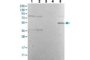 Western Blot analysis with DES polyclonal antibody  Lane 1: Human cell line RT-4 Lane 2: Human cell line U-251MG sp Lane 3: Human plasma (IgG/HSA depleted) Lane 4: Human liver tissue Lane 5: Human tonsil tissue (Desmin antibody)