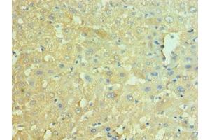 Immunohistochemistry of paraffin-embedded human liver tissue using ABIN7161572 at dilution of 1:100 (NAMPT antibody  (AA 1-280))