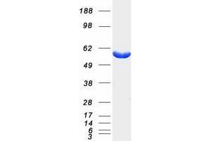 Validation with Western Blot