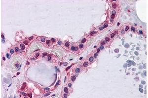 Human Thyroid: Formalin-Fixed, Paraffin-Embedded (FFPE) (Hepcidin antibody  (AA 25-85))