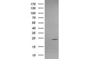 Image no. 2 for anti-Amyloid P Component, Serum (APCS) antibody (ABIN1500898) (APCS antibody)