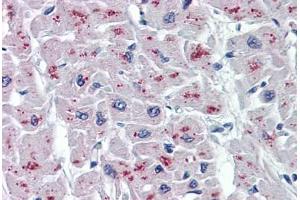 Human Heart: Formalin-Fixed, Paraffin-Embedded (FFPE) (ASAH1 antibody  (AA 25-125))