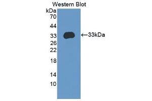 Western blot analysis of the recombinant protein. (Integrin beta 4 antibody  (AA 1098-1356))