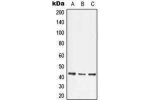 Western blot analysis of LMX1B expression in HeLa (A), Jurkat (B), SP2/0 (C) whole cell lysates. (LMX1B antibody  (Center))