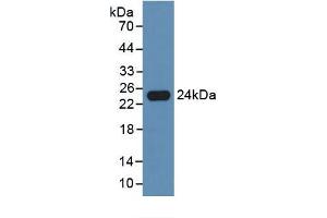 SDS-PAGE of Protein Standard from the Kit (Highly purified E. (IL-10 ELISA Kit)