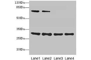 Western blot All lanes: SPIN3 antibody at 6 μg/mL Lane 1: A549 whole cell lysate Lane 2: Hela whole cell lysate Lane 3: A431 whole cell lysate Lane 4: HepG2 whole cell lysate Secondary Goat polyclonal to rabbit IgG at 1/10000 dilution Predicted band size: 30, 9 kDa Observed band size: 30, 70 kDa (SPIN3 antibody  (AA 1-77))