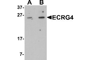 Western blot analysis of ECRG4 in HeLa cell lysate with ECRG4 antibody at (A) 1 and (B) 2 µg/mL. (C2orf40 antibody  (C-Term))