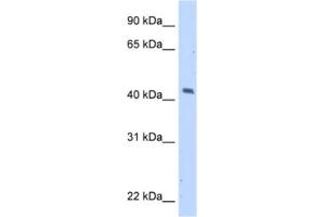 Western Blotting (WB) image for anti-Melanoma Antigen Family A, 1 (Directs Expression of Antigen MZ2-E) (MAGEA1) antibody (ABIN2462943) (MAGEA1 antibody)