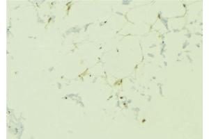 ABIN6276695 at 1/100 staining Human lung tissue by IHC-P. (Adiponectin Receptor 1 antibody  (C-Term))